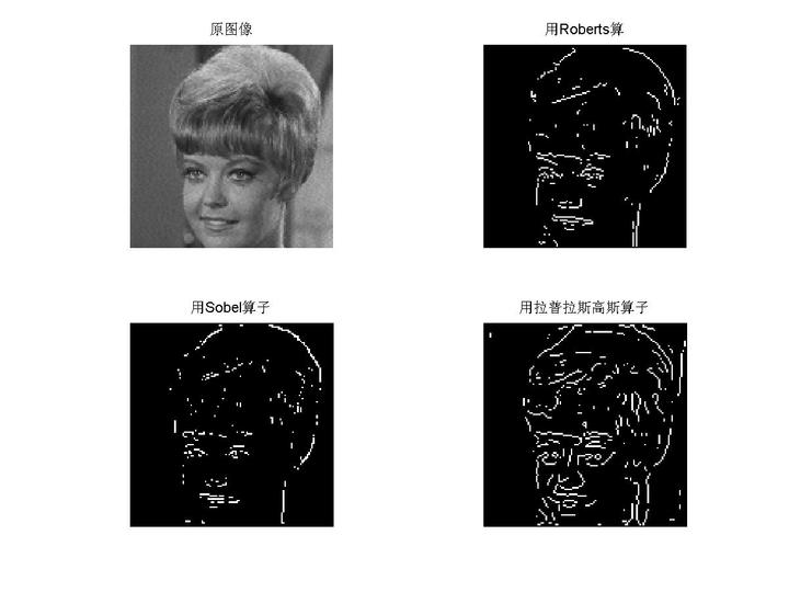 v2-eff91d0eefedd880fb8bf6d49ff6513c\_b.jpg