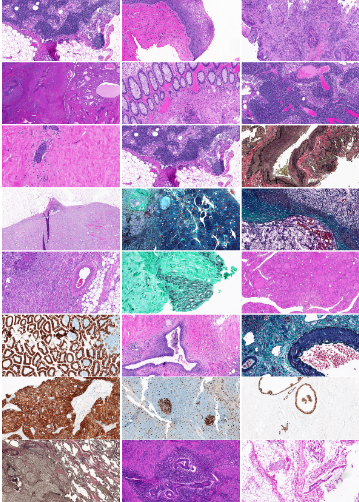 Kimia Path 24数据集论文Classification and Retrieval of Digital Pathology Scans A New Dataset笔记